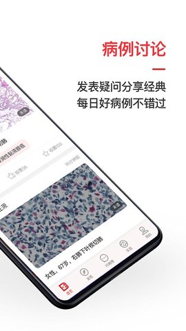 爱病理app 3.6.12 安卓版